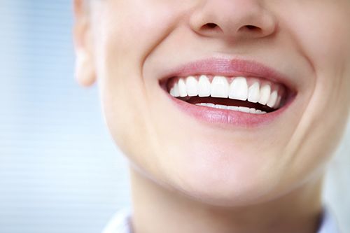 women smiling with straight white teeth